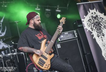 Organectomy - Photo by Dänu