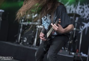 Organectomy - Photo by Dänu