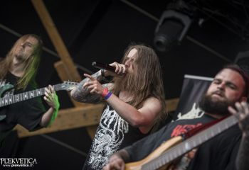 Organectomy - Photo by Dänu