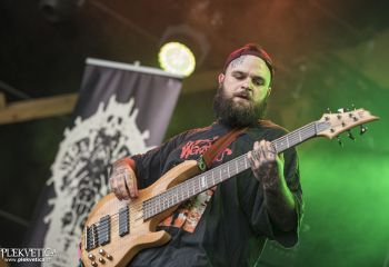 Organectomy - Photo by Dänu