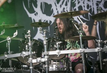 Organectomy - Photo by Dänu