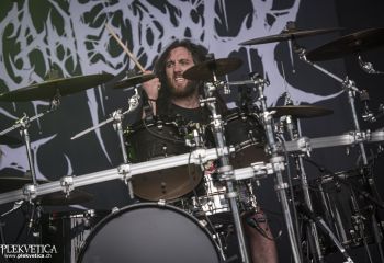 Organectomy - Photo by Dänu