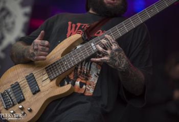 Organectomy - Photo by Dänu