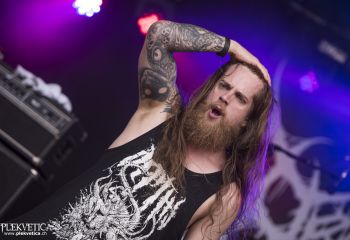 Organectomy - Photo by Dänu