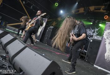 Organectomy - Photo by Dänu