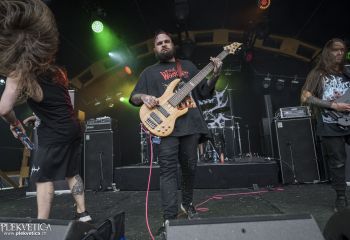 Organectomy - Photo by Dänu