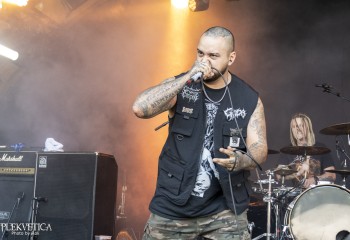 Epicardiectomy - Photo by Roli