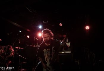 Organectomy - Photo By Juwal