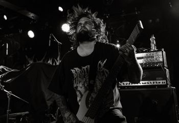 Organectomy - Photo By Juwal