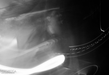 Trepaneringsritualen - Photo by Natalie