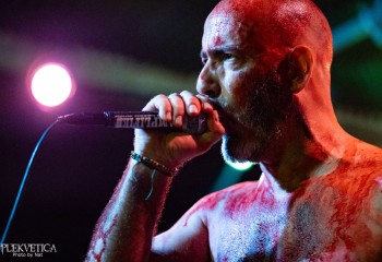 Bleeding Display - Photo by Natalie