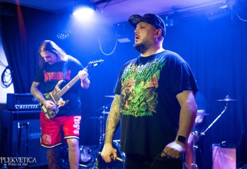 Craniotomy - Photo by Natalie