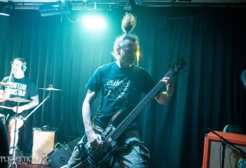 Craniotomy - Photo by Natalie