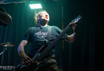 Craniotomy - Photo by Natalie