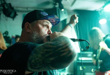 Craniotomy - Photo by Natalie