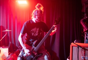 Craniotomy - Photo by Natalie