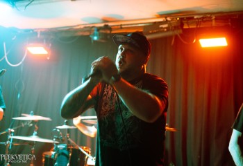 Craniotomy - Photo by Natalie