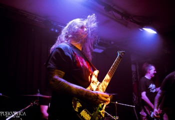 Craniotomy - Photo by Natalie