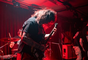 Craniotomy - Photo by Natalie