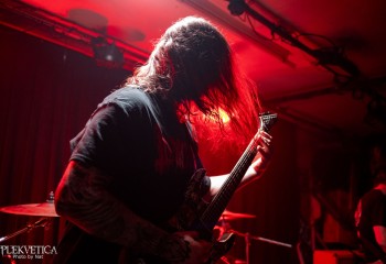 Craniotomy - Photo by Natalie