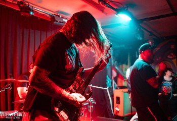 Craniotomy - Photo by Natalie