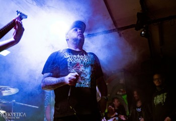 Craniotomy - Photo by Natalie