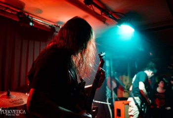 Craniotomy - Photo by Natalie