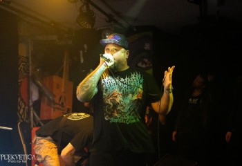 Craniotomy - Photo by Natalie