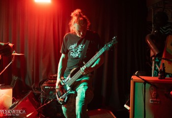 Craniotomy - Photo by Natalie