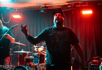 Craniotomy - Photo by Natalie