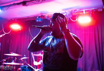 Craniotomy - Photo by Natalie