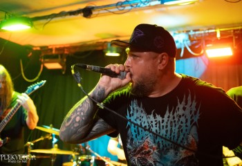 Craniotomy - Photo by Natalie