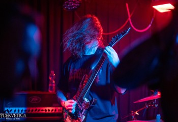 Craniotomy - Photo by Natalie