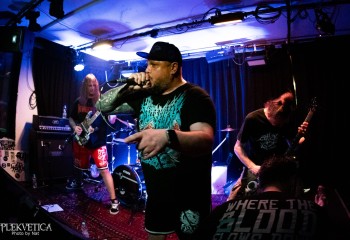 Craniotomy - Photo by Natalie