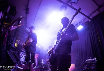 Craniotomy - Photo by Natalie