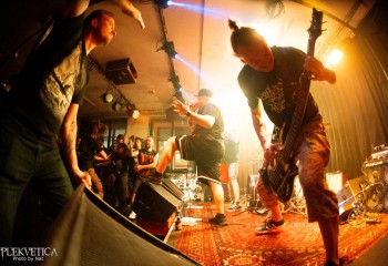 Craniotomy - Photo by Natalie