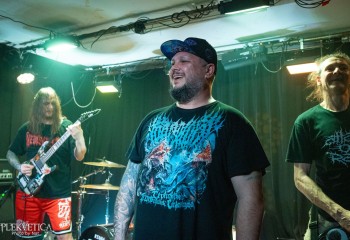 Craniotomy - Photo by Natalie