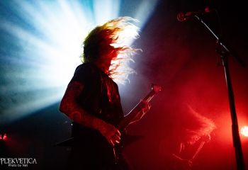 Hyperdontia - Photo by Natalie