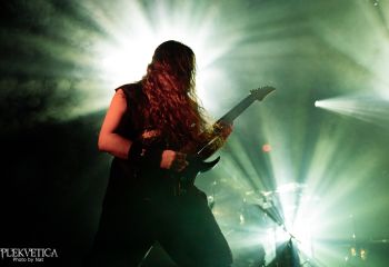 Hyperdontia - Photo by Natalie