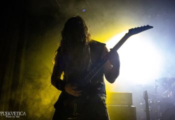 Hyperdontia - Photo by Natalie