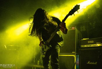 Hyperdontia - Photo by Natalie