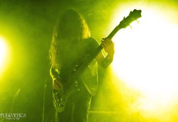 Hyperdontia - Photo by Natalie