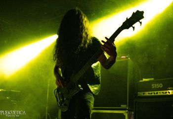 Hyperdontia - Photo by Natalie