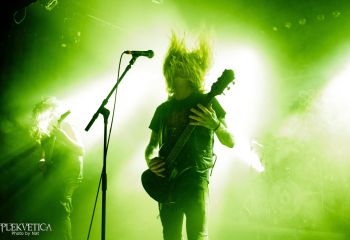 Hyperdontia - Photo by Natalie