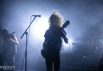 Hyperdontia - Photo by Natalie