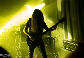 Hyperdontia - Photo by Natalie