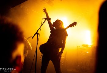 Hyperdontia - Photo by Natalie