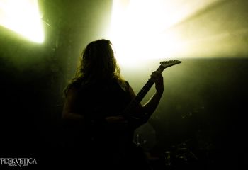 Hyperdontia - Photo by Natalie