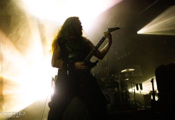 Hyperdontia - Photo by Natalie