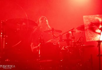 Hyperdontia - Photo by Natalie